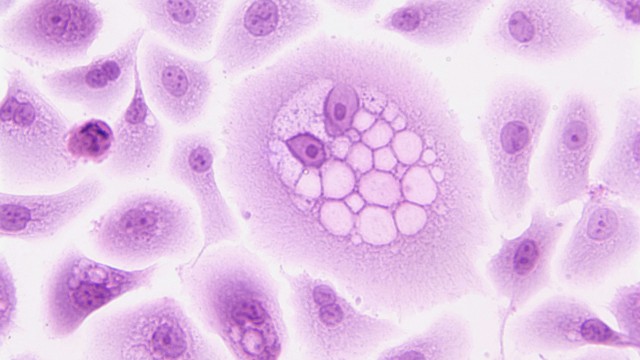 Pathoepidemiology & Molecular Pathoepidemiology